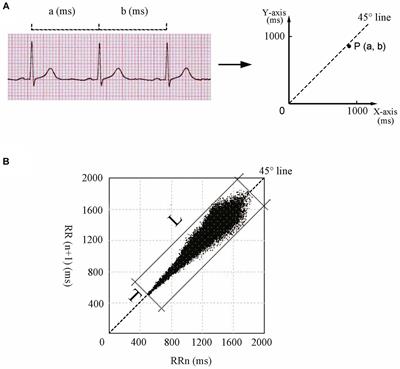 Poincaré plot can help predict the curative effect of metoprolol for pediatric postural orthostatic tachycardia syndrome